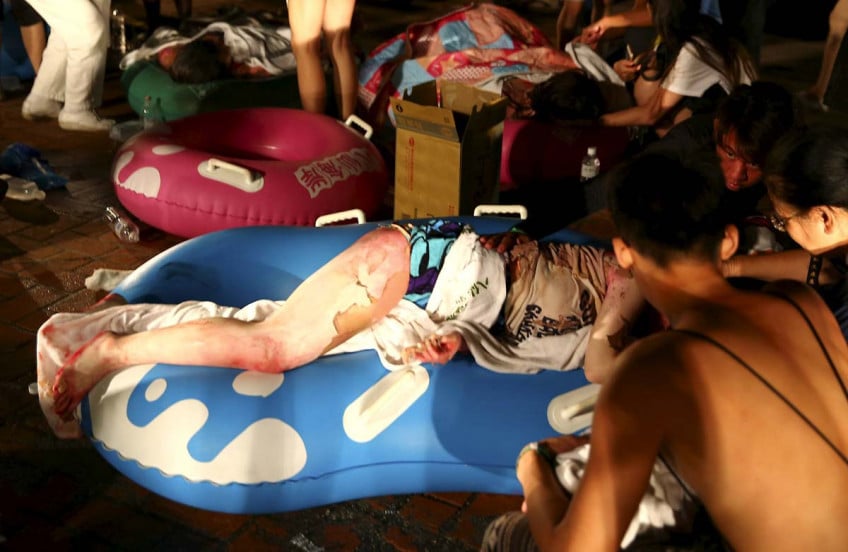 A burn casualty lays across an inflatable pool toy during a burn MCI in Taiwan