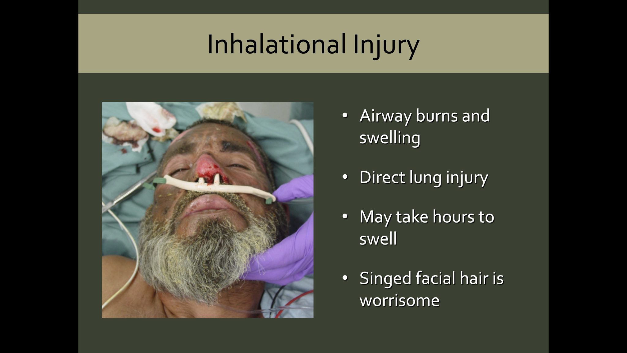 A Airway Crisis Medicine