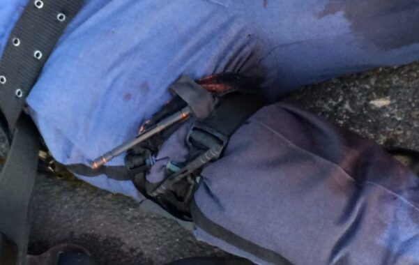 A photo of a police officer's leg showing two, side-by-side CAT tourniquets properly applied to stop massive hemorrhage