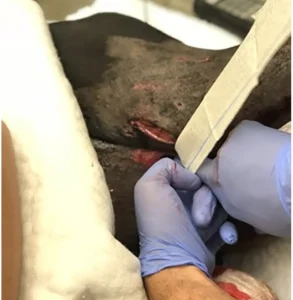 A photo showing combat gauze being packed into the left inguinal wound of a Doberman Pinscher that sustained an attack by another dog. The wound was actively hemorrhaging secondary to injury to the femoral artery and vein. Photo from The use of a kaolin-based hemostatic dressing to attenuate bleeding in dogs: A series of 4 cases. Huther A, Edwards TH. Vet Emerg Crit Care (San Antonio) . 2024 Mar-Apr;34(2):166-172.