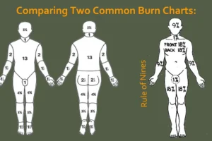 Diagrams comparing burn BSA from two different methods