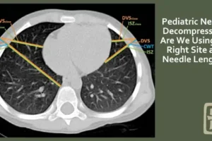 A chest CT image of a pediatric patient, labeling how close the internal structures are to the chest wall