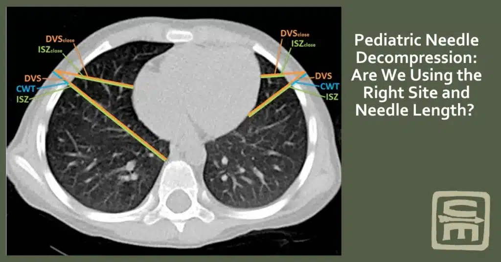 A chest CT image of a pediatric patient, labeling how close the internal structures are to the chest wall